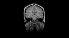 godhelm_magnetic-resonance-imaging.png