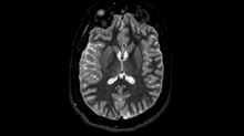 godhelm_mri-animation.gif
